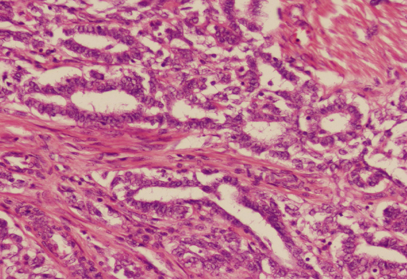 Best Histopathology lab in Newtown