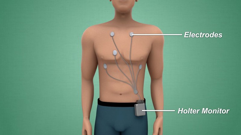 Best Holter monitoring lab in Newtown