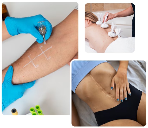 Benefits of Scar Reduction Treatments Benefits of Scar Reduction Treatments