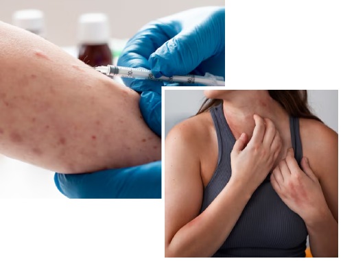 Causes of Dermatological Diseases Causes of Dermatological Diseases