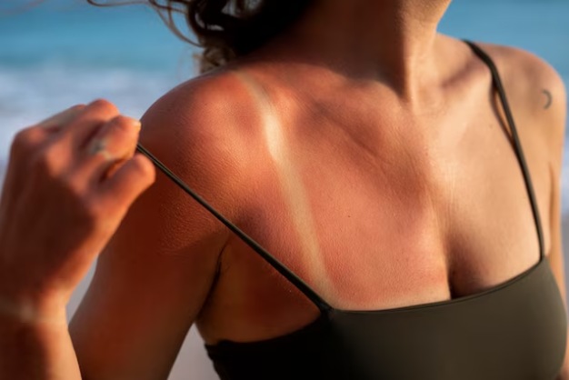 Sun Damage Sun Damage