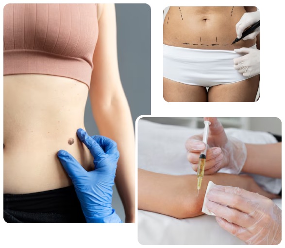 Types of Skin Fillers Types of Skin Fillers