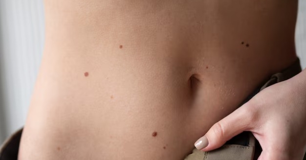 Scar Reduction Treatment in Newtown Scar Reduction Treatment in Newtown