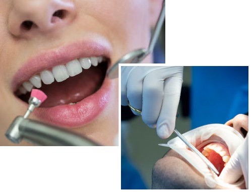 Causes of Advanced Gum Disease Causes of Advanced Gum Disease