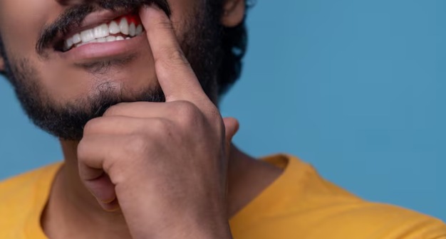 Diagnosis of Advanced Gum Disease Diagnosis of Advanced Gum Disease