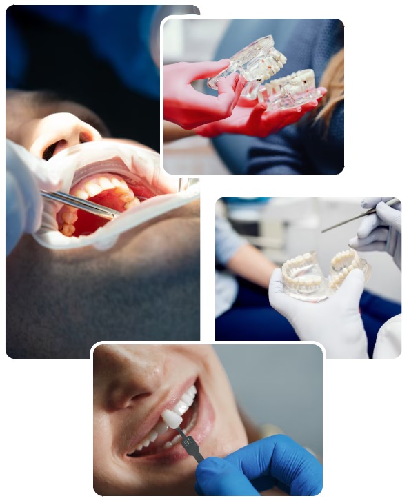 Dental Implants Treatment Procedure Dental Implants Treatment Procedure