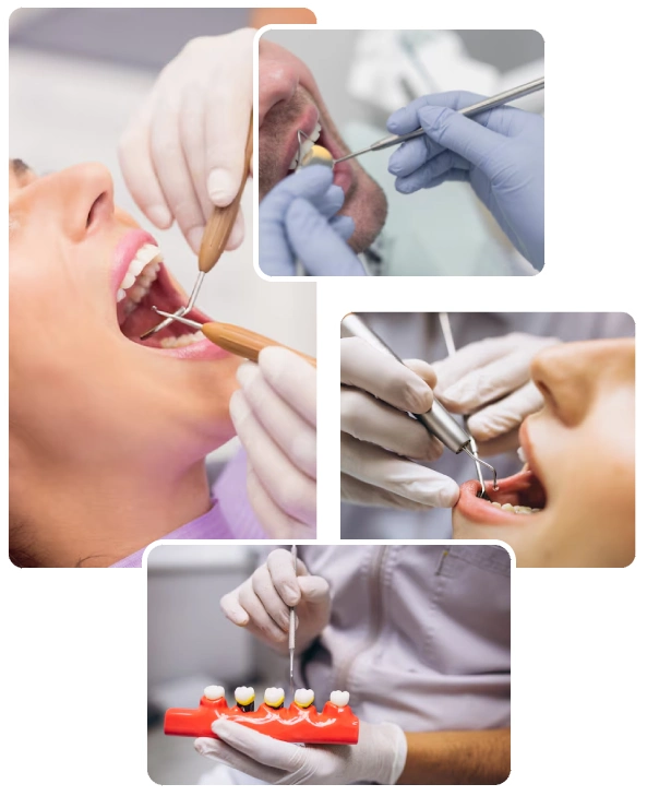 Types of Advanced Gum Disease Types of Advanced Gum Disease