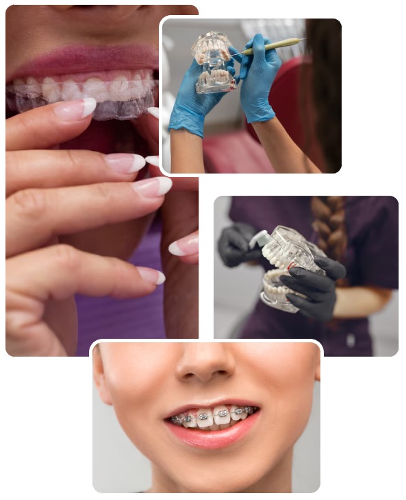 Types of Teeth Alignment Types of Teeth Alignment