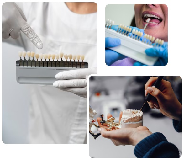 Best Dental Implants in Newtown Best Dental Implants in Newtown