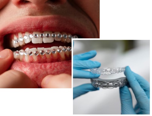 Best Teeth Alignment Clinic in Newtown Best Teeth Alignment Clinic in Newtown